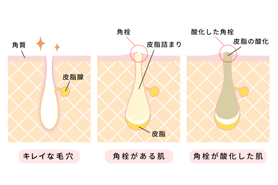 毛穴の図解