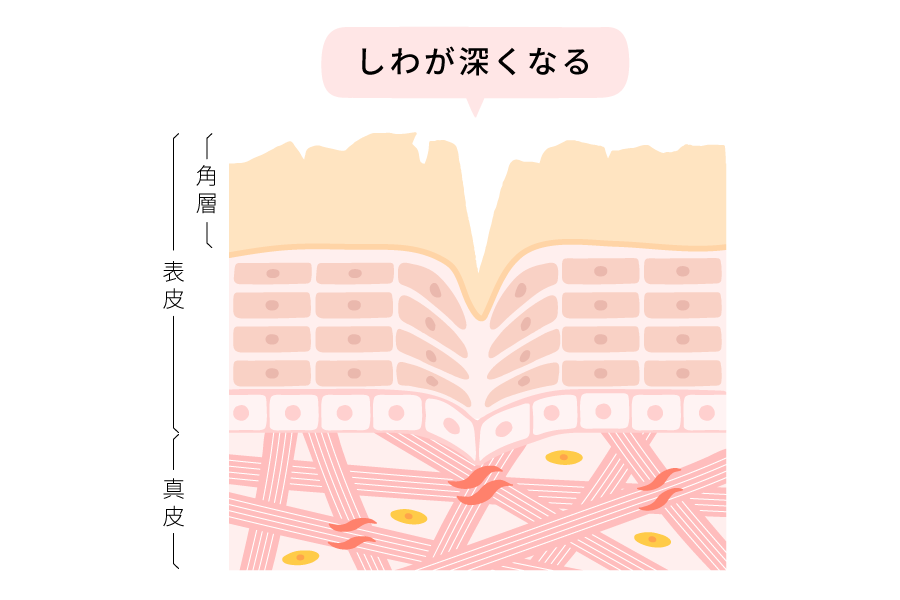 毛穴の図解