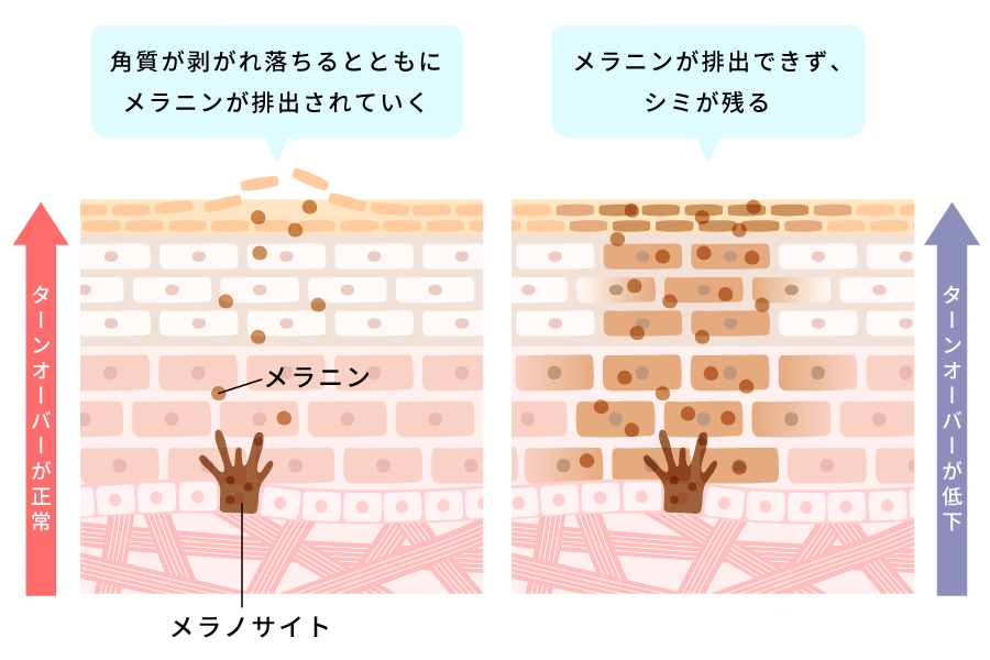 毛穴の図解