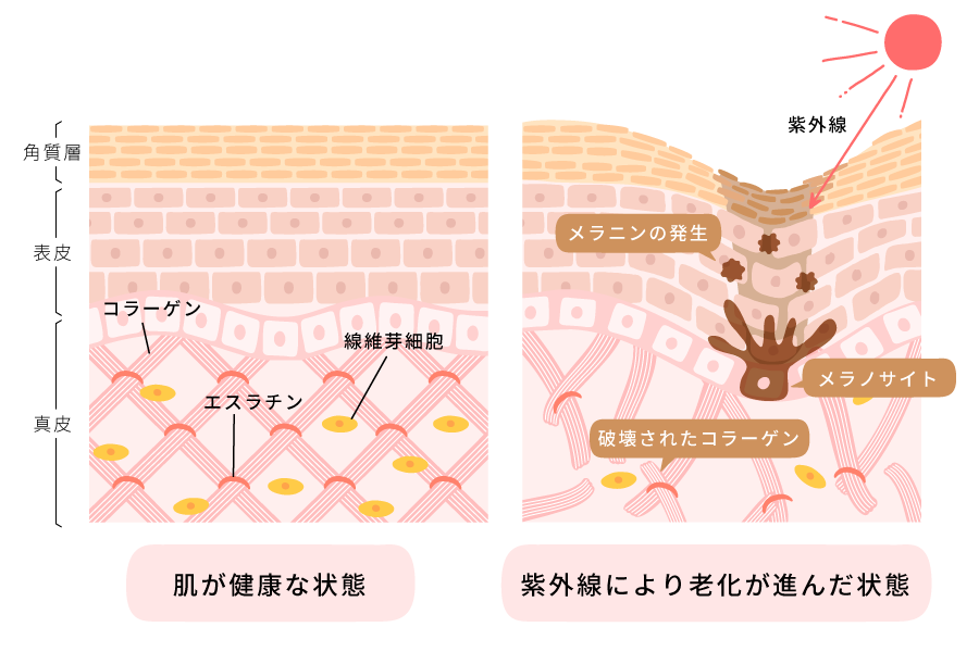 毛穴の図解
