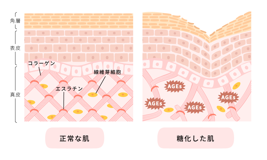 毛穴の図解