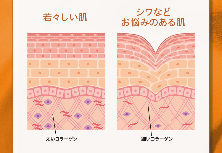 若々しい肌 シワなどお悩みのある肌