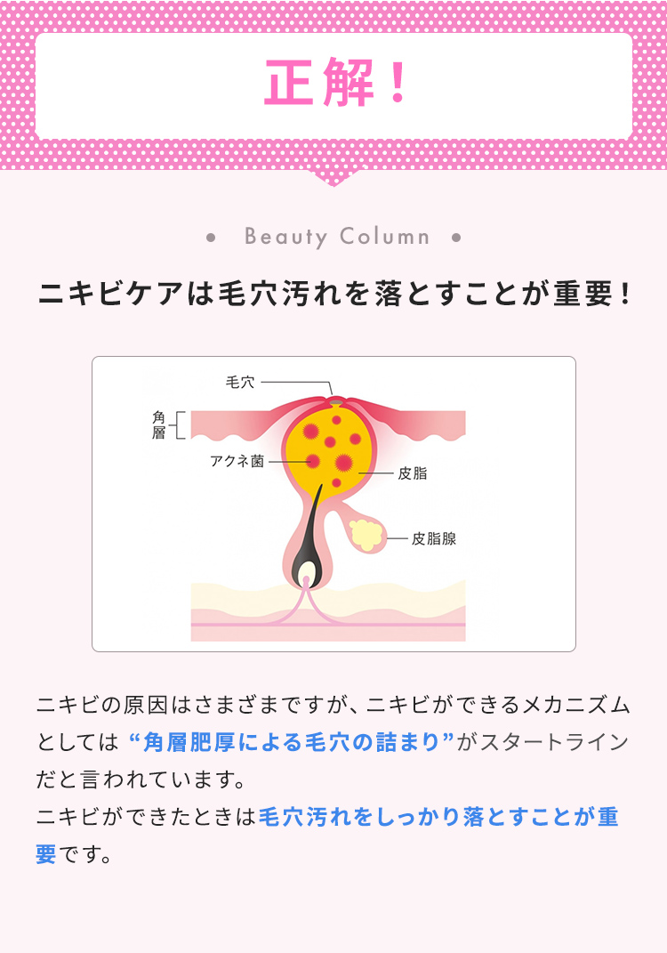 正解！【ニキビケアは毛穴汚れを落とすことが重要！】